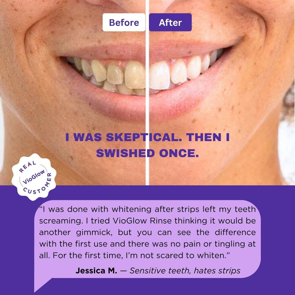 VioGlow Rinse — Purple Color‑Correcting Whitening Mouthwash Sachets