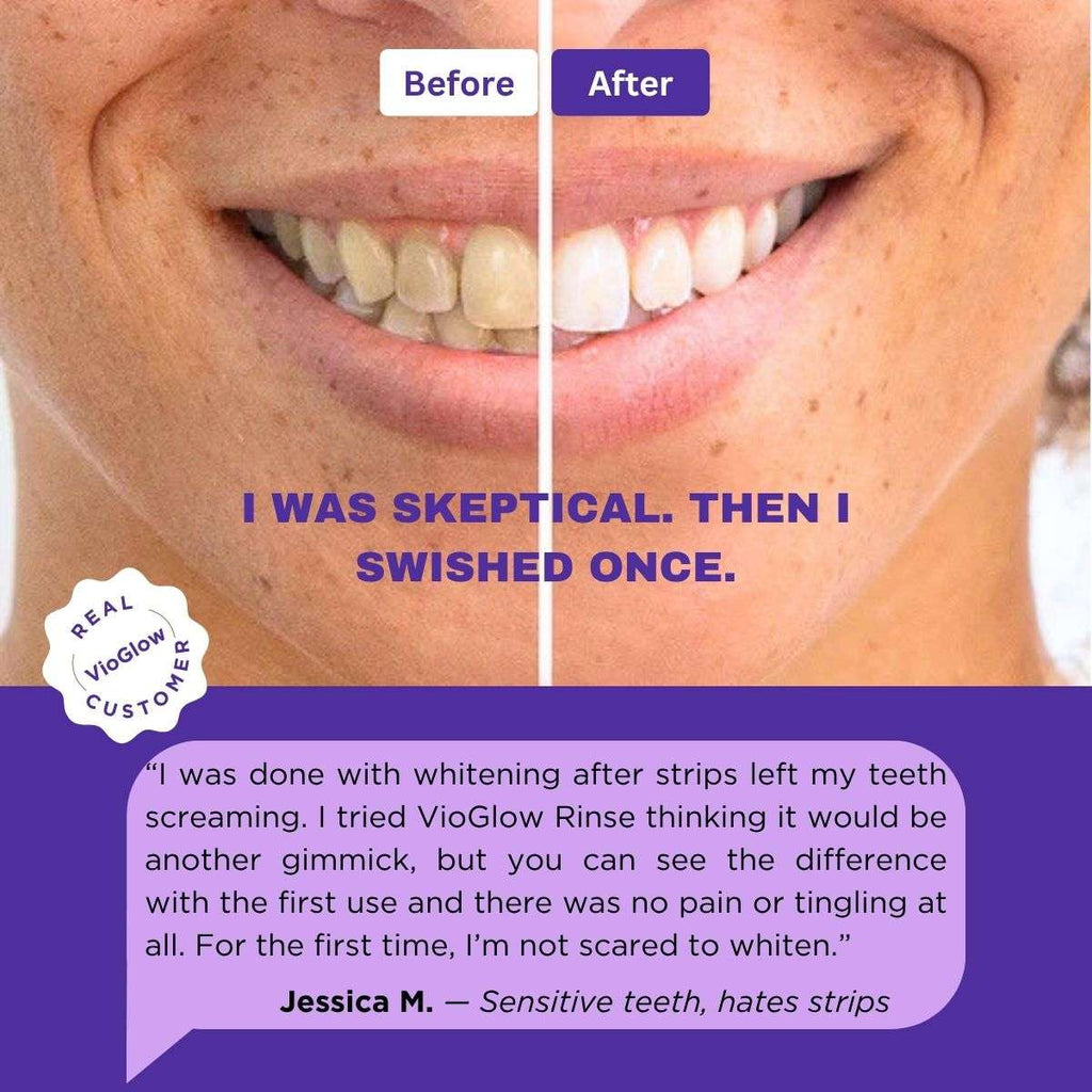 VioGlow Rinse — Purple Color‑Correcting Whitening Mouthwash Sachets Concept7